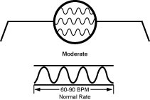 p.moderate p.moderate The Moderate, Slowed down, Lax, Retarded, Leisurely Pulse (Huan Mai)