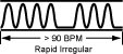 p.rapid.irreg p.rapid.irreg The Rapid Irregular, Hasty, Abrupt, Skipping Pulse (Cu Mai)